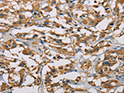 PIP4K2A Antibody