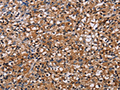 NPM3 Antibody