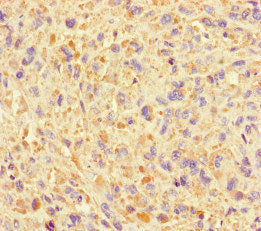 SUMO2 Antibody