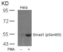 Phospho-SMAD1 (Ser465) Antibody