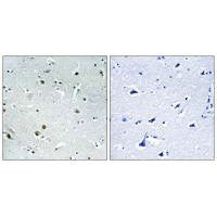 DDX24 Antibody