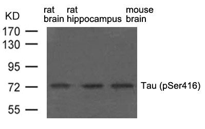Phospho-MAPT (Ser416) Antibody