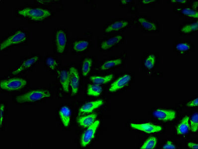 LYPLA2 Antibody