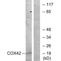 COX4I2 Antibody
