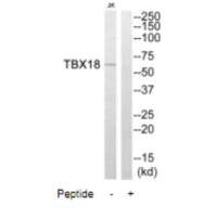 TBX18 Antibody
