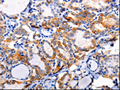 AP1B1 Antibody