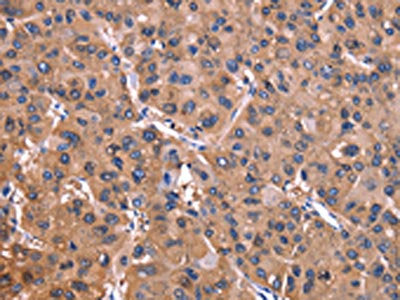 ADM2 Antibody