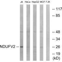 NDUFV2 Antibody