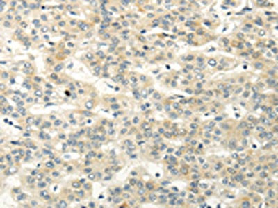 VIPR1 Antibody
