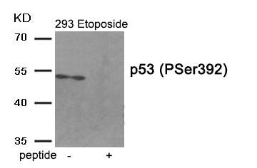 Phospho-TP53 (Ser392) Antibody
