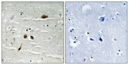 Phospho-MDC1 (Ser513) Antibody