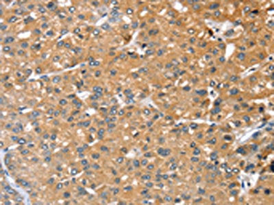 RASAL1 Antibody