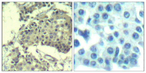 MTOR (Ab-2481) Antibody