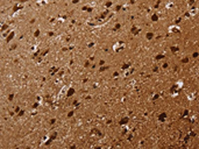 KARS Antibody