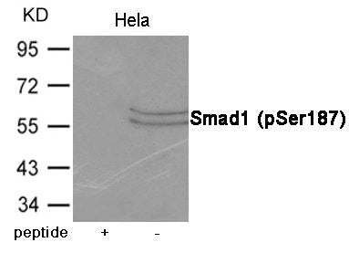 Phospho-SMAD1 (Ser187) Antibody