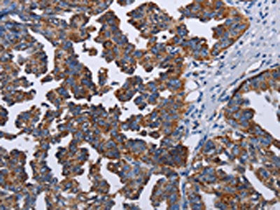 TRIM13 Antibody