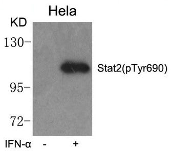 Phospho-STAT2 (Tyr690) Antibody