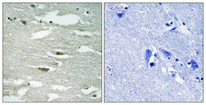 Phospho-ILK (Ser246) Antibody