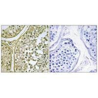 CSNK1A1L/CSNK1A1 Antibody