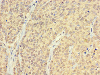 AR Antibody