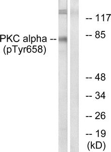 Phospho-PRKCA (Tyr658) Antibody