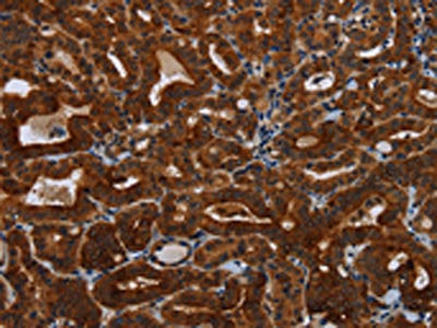 KLHL1 Antibody