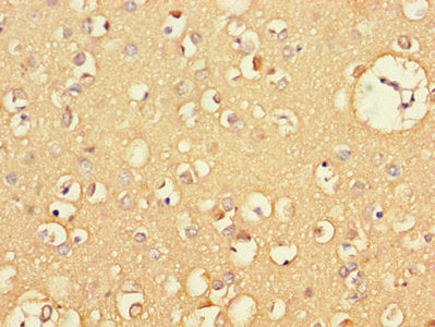 CXCL11 Antibody