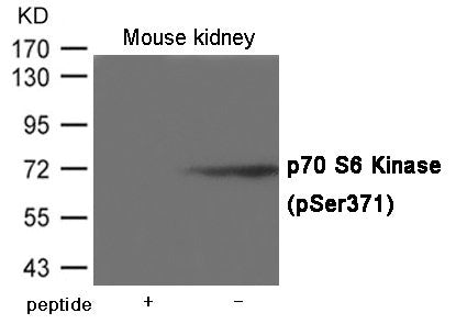 Phospho-RPS6KB1 (Ser371) Antibody