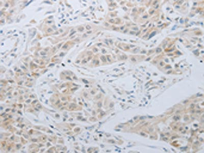 LOX Antibody
