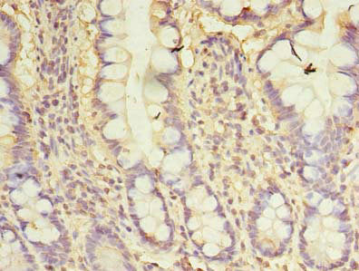 CXCL6 Antibody