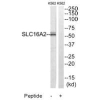 SLC16A2 Antibody