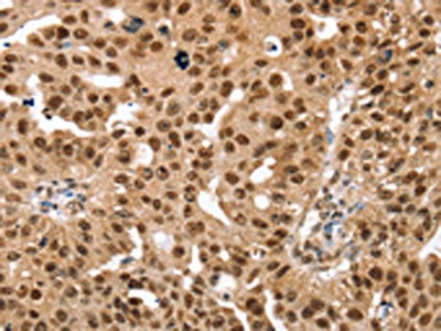 SMARCB1 Antibody