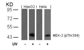 Phospho-MAP2K2 (Thr394) Antibody