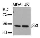 TP53 (Ab-15) Antibody