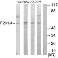 PFKFB1/PFKFB4 Antibody