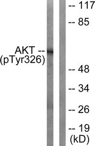 Phospho-AKT1 (Tyr326) Antibody