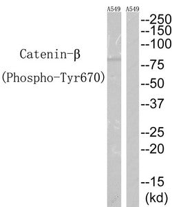 Phospho-CTNNB1 (Tyr670) Antibody