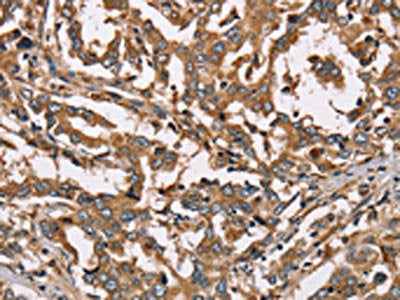 HSD17B12 Antibody