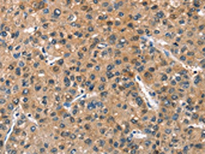 ASB2 Antibody