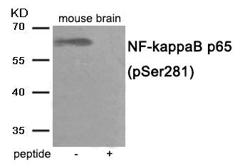 Phospho-RELA (Ser281) Antibody