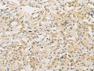 FNTA Antibody