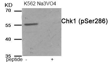 Phospho-CHEK1 (Ser286) Antibody