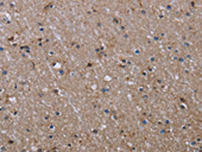 ITGB2 Antibody