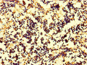 IL17A Antibody