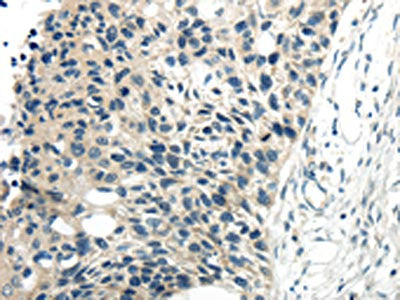 CYP19A1 Antibody