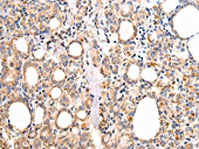 UQCRC1 Antibody