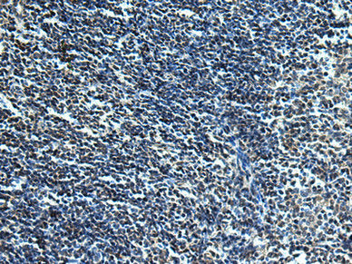 SLC2A12 Antibody