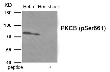 Phospho-PRKCB (Ser661) Antibody
