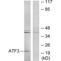 ATF3 Antibody