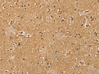 RASSF1 Antibody